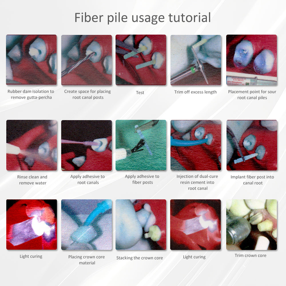 Fiberglass Dental Post - Endodontic Post,Multicolor selection