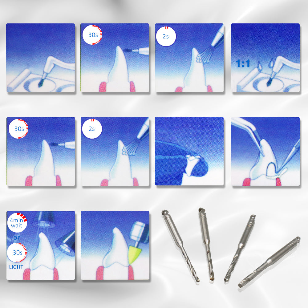 Fiberglass Dental Post - Endodontic Post,Multicolor selection