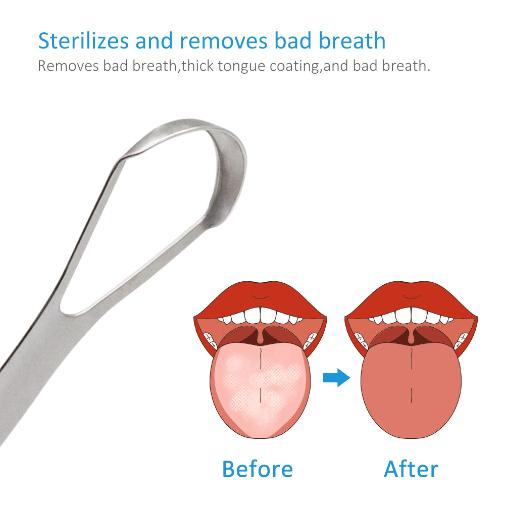 PROTECTOR Stainless Steel Tongue Scraper – With Metal Storage Box