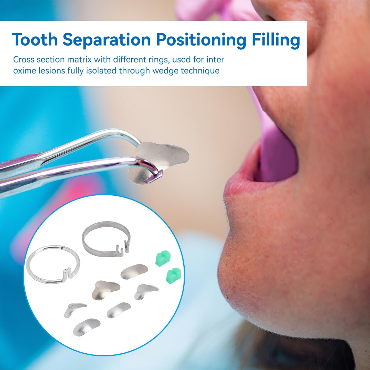 100/Box Dental Section Profile Matrix, Professional Dental Filling Matrix with Dental Filling Matrix with 2 Rings, 20 Circle Wedge Orthodontic Items