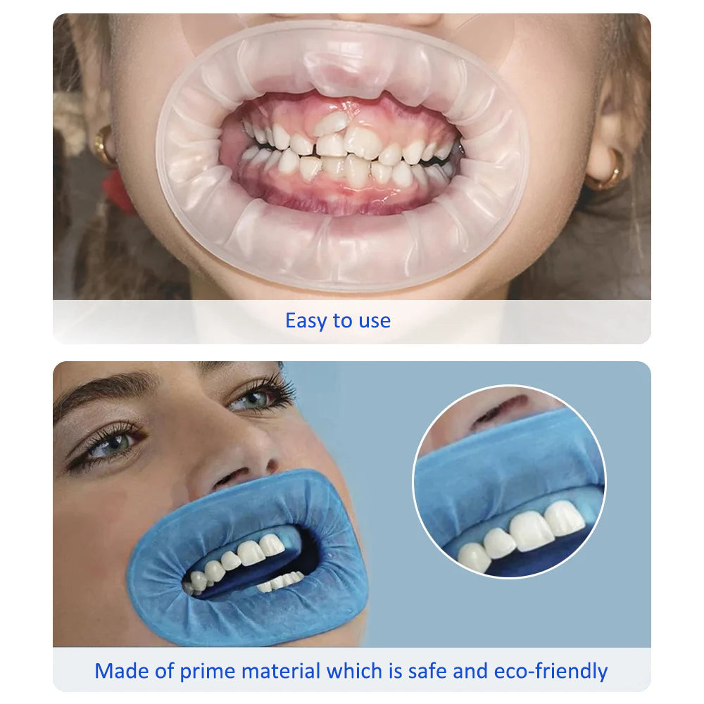 10 pcs Rubber Dam Mouth Opener Dental Disposable Oral Cheek Lip Retractor for Surgery Expander Retractor Teeth Whitening