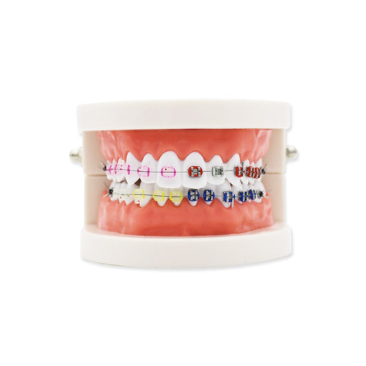 Dental Teeth Model,Transparent Dental Implant Teeth Model Dentist Standard Disease Removable Tooth Pathological Teaching Model