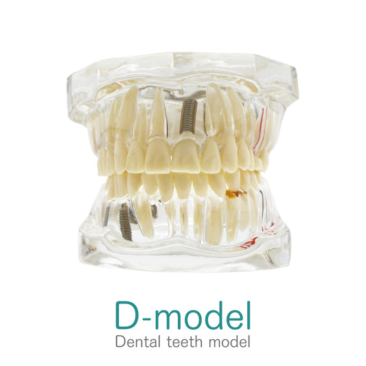 Transparent Disease Teeth Model, YOUYA DENTAL Transparent Dental Implant Teeth Model Dentist Standard Disease Removable Tooth Pathological Teaching Model