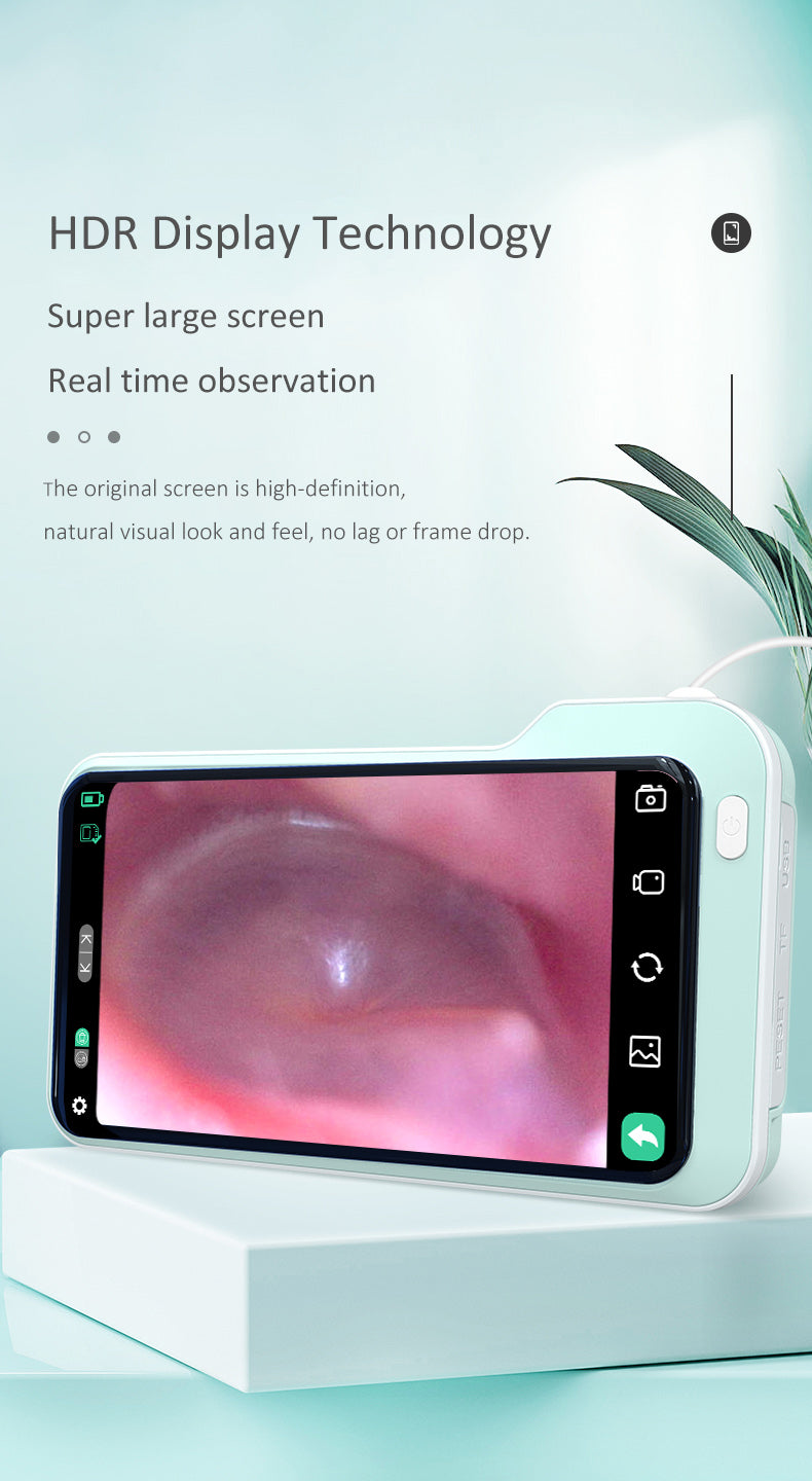 Ear Wax Removal Tool Camera Smart Visual Ear Wax Cleaner 5 million HD visual ear pick Luminous ear pick Children visual ear pick 3.9mm 1080P