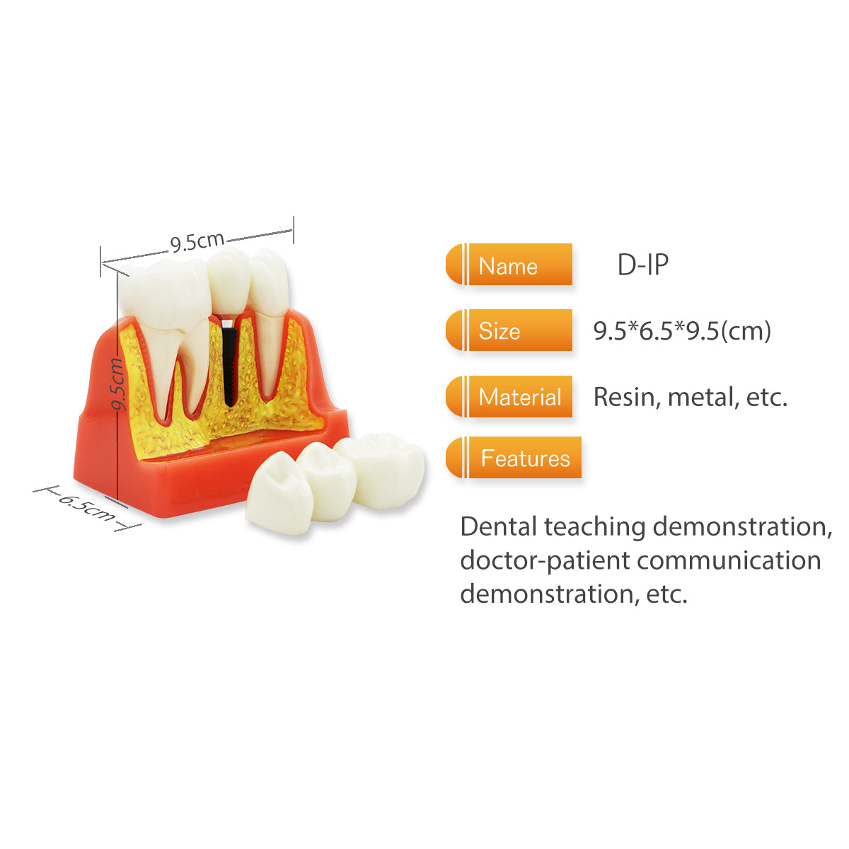 Dental Teeth Model,Transparent Dental Implant Teeth Model Dentist Standard Disease Removable Tooth Pathological Teaching Model(D-IP)