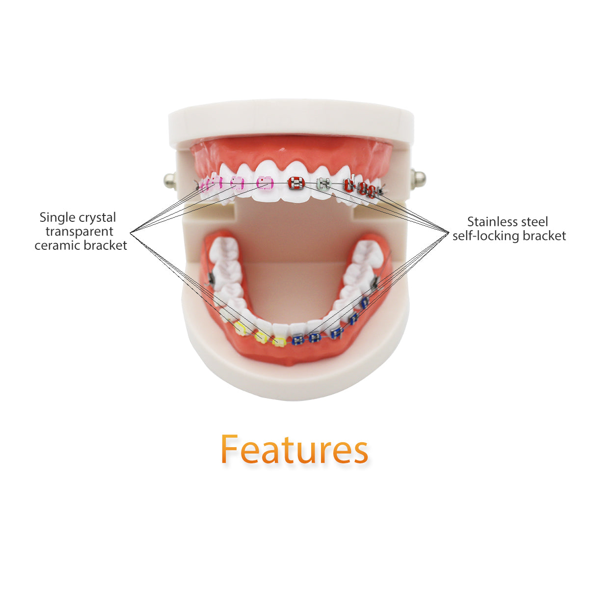 Dental Teeth Model,Transparent Dental Implant Teeth Model Dentist Standard Disease Removable Tooth Pathological Teaching Model (D-OR)