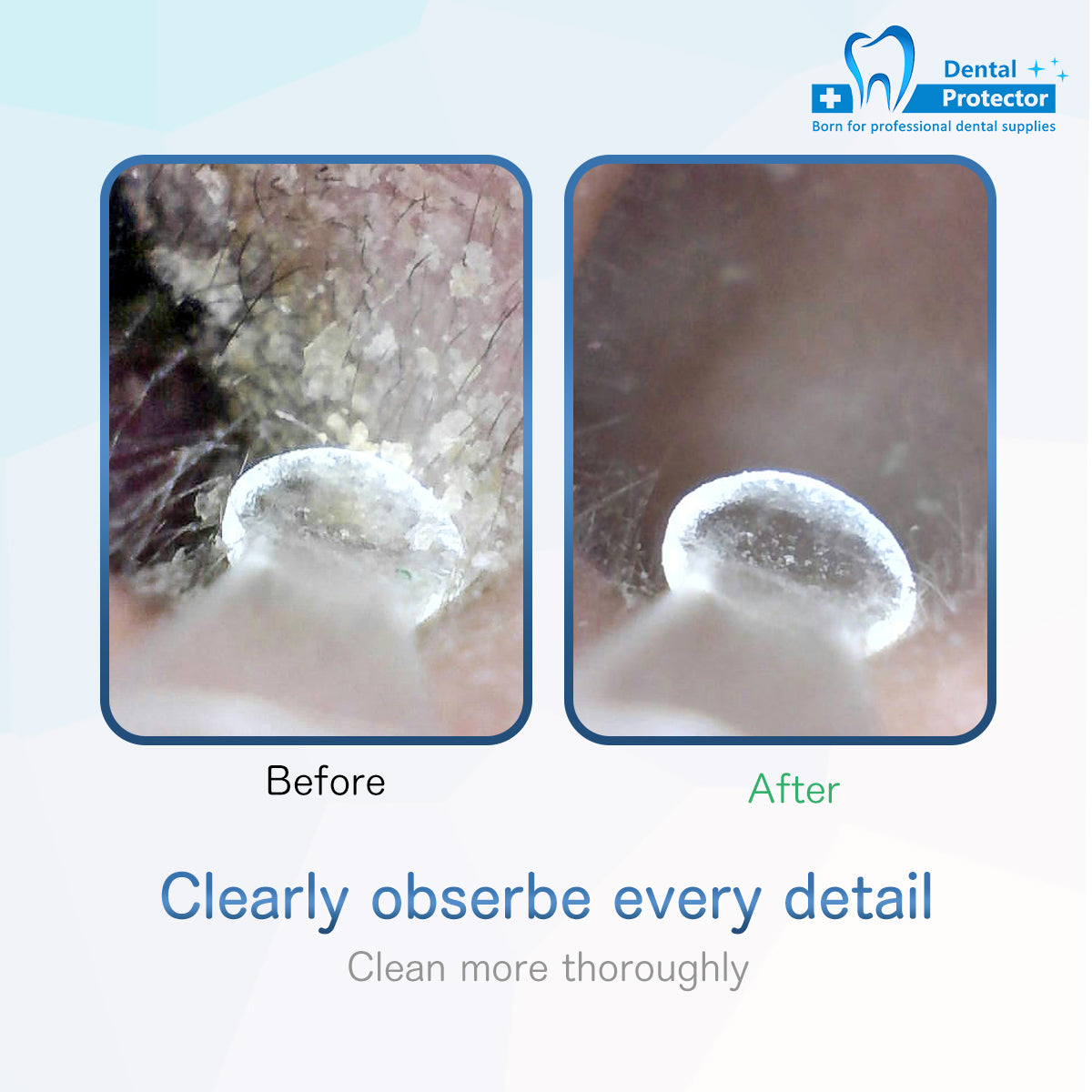 Wireless integrated WiFi 3.9mm ear endoscope HD ear spoon medical assured convenient safe waterproof camera ear canal mirror iPhone