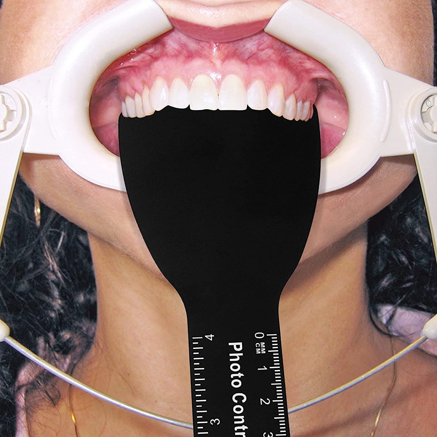 6 Pcs Dental Contraster Intraoral Photographic Dental Black Background Board Dental Photo Contrast Kit