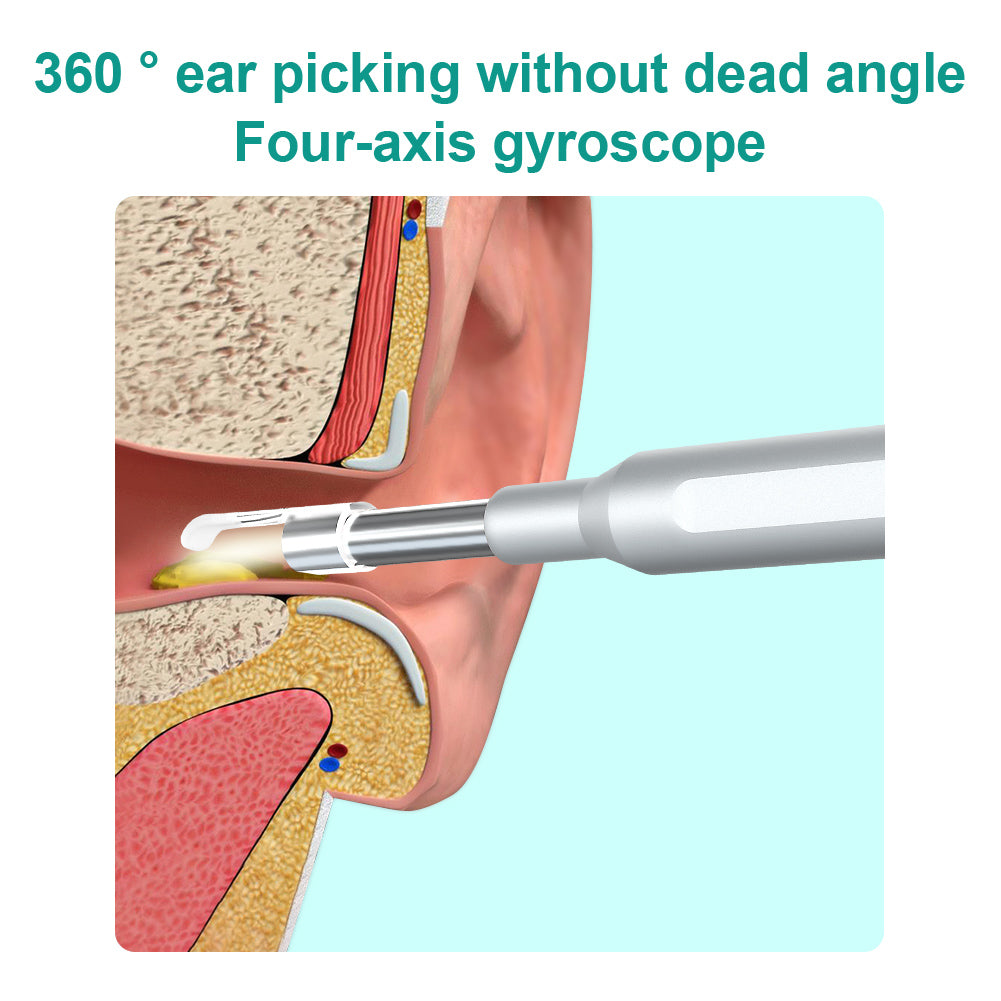 Ear Wax Removal Tool Camera Smart Visual Ear Wax Cleaner 5 million HD visual ear pick Luminous ear pick Children visual ear pick 3.9mm 1080P