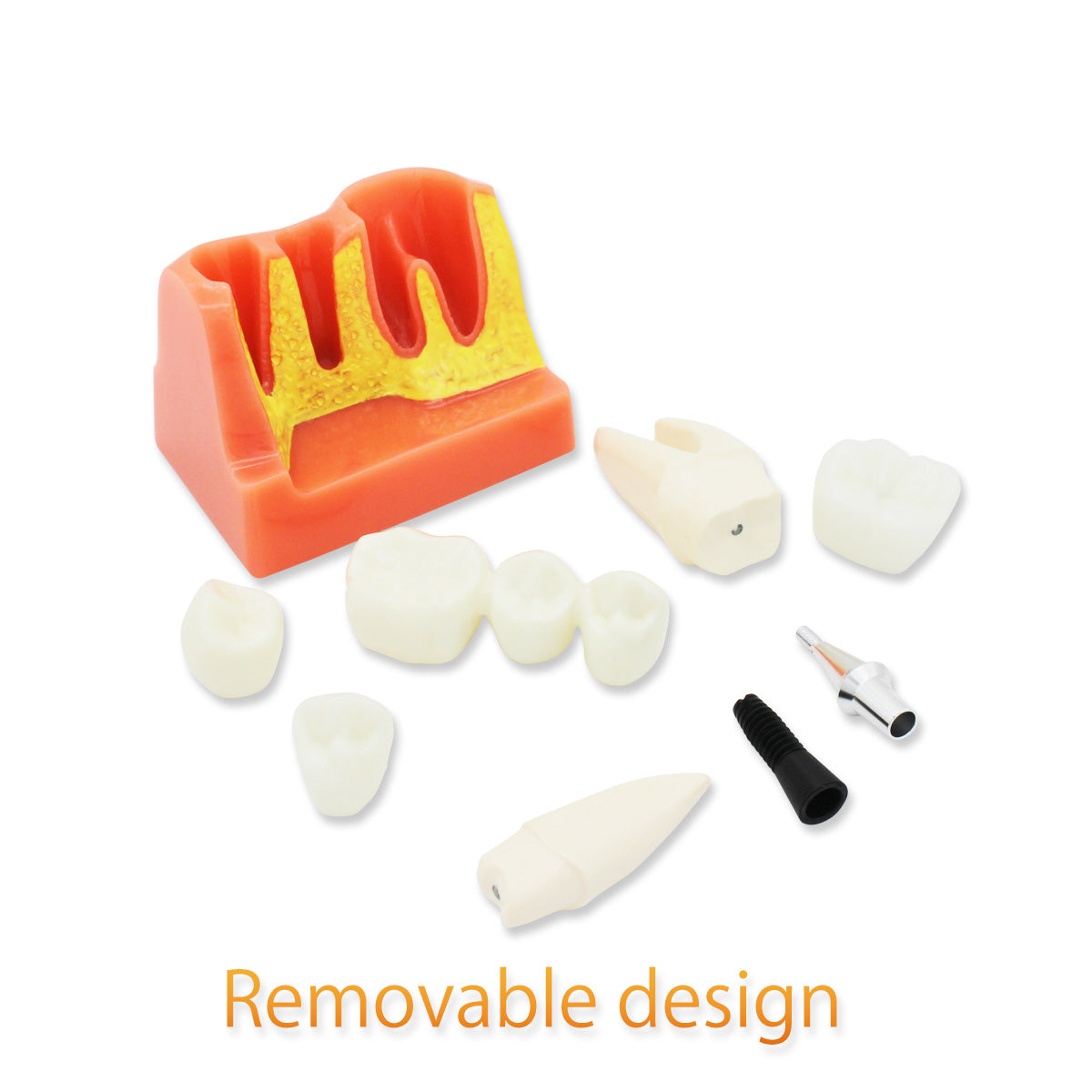 Dental Teeth Model,Transparent Dental Implant Teeth Model Dentist Standard Disease Removable Tooth Pathological Teaching Model(D-IP)