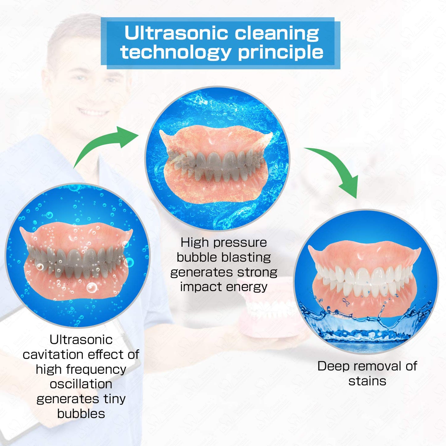 Ultrasonic Denture Cleaner Profession Retainer/Aligner/Mouth Guard Cleaner Machine, SUS304 Material 5 Minute Quick Cleaning