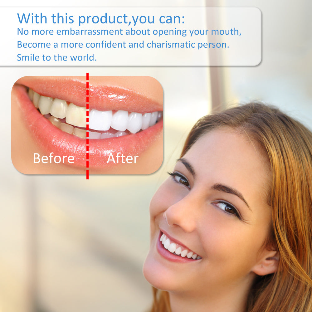 Teeth Whitening Light Kit - 5X LED Light Tooth Whitener with 35% Carbamide Peroxide, Mouth Trays, Remineralizing Gel and Tray Case - Built-In 10 Minute Timer Restores Your Smile Confidently