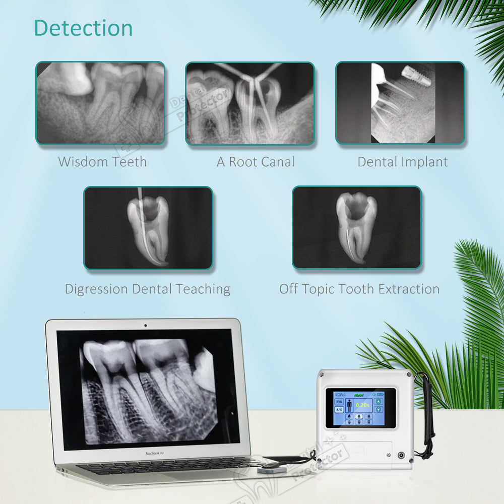 E-VO Touch Screen X Ray Camera Original 100% HyperLight X-Ray Machine Wireless One Hand Portable Dental RVG Image Sensor System