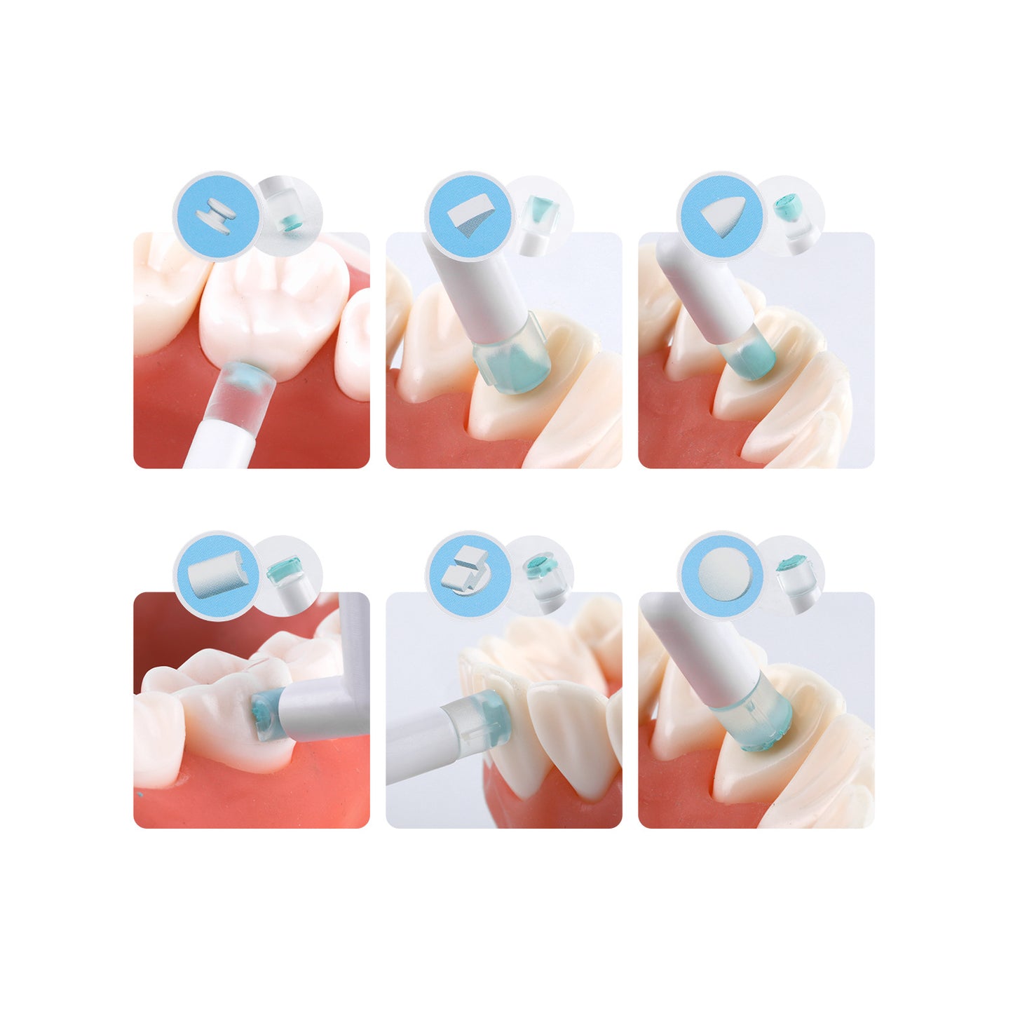 MO-6 Orthodontic Mould Mold Mini Orthodontic Accessories Injection Mould Starter Kit Tubes Lingual Retainer Button Set
