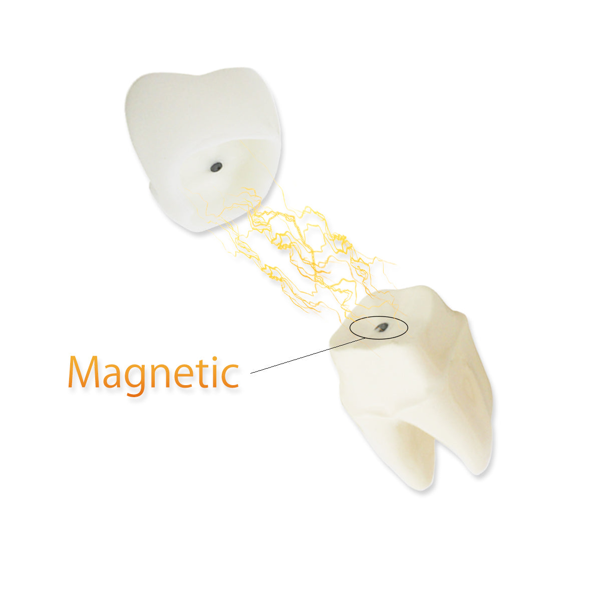 Dental Teeth Model,Transparent Dental Implant Teeth Model Dentist Standard Disease Removable Tooth Pathological Teaching Model(D-IP)