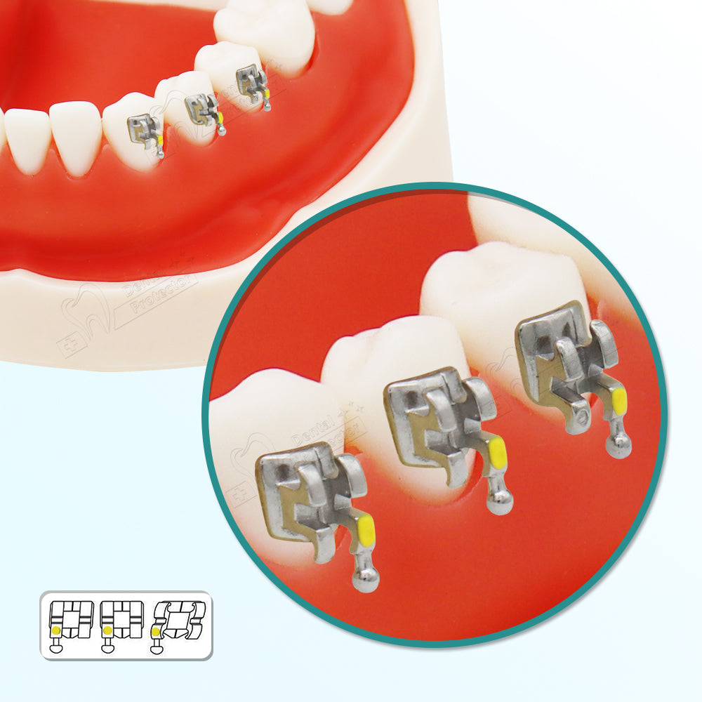 10 Sets/Pack 200 pcs of Brackets 022 inch Slot 3-4-5 Hooks Mini size MBT Metal Brackets