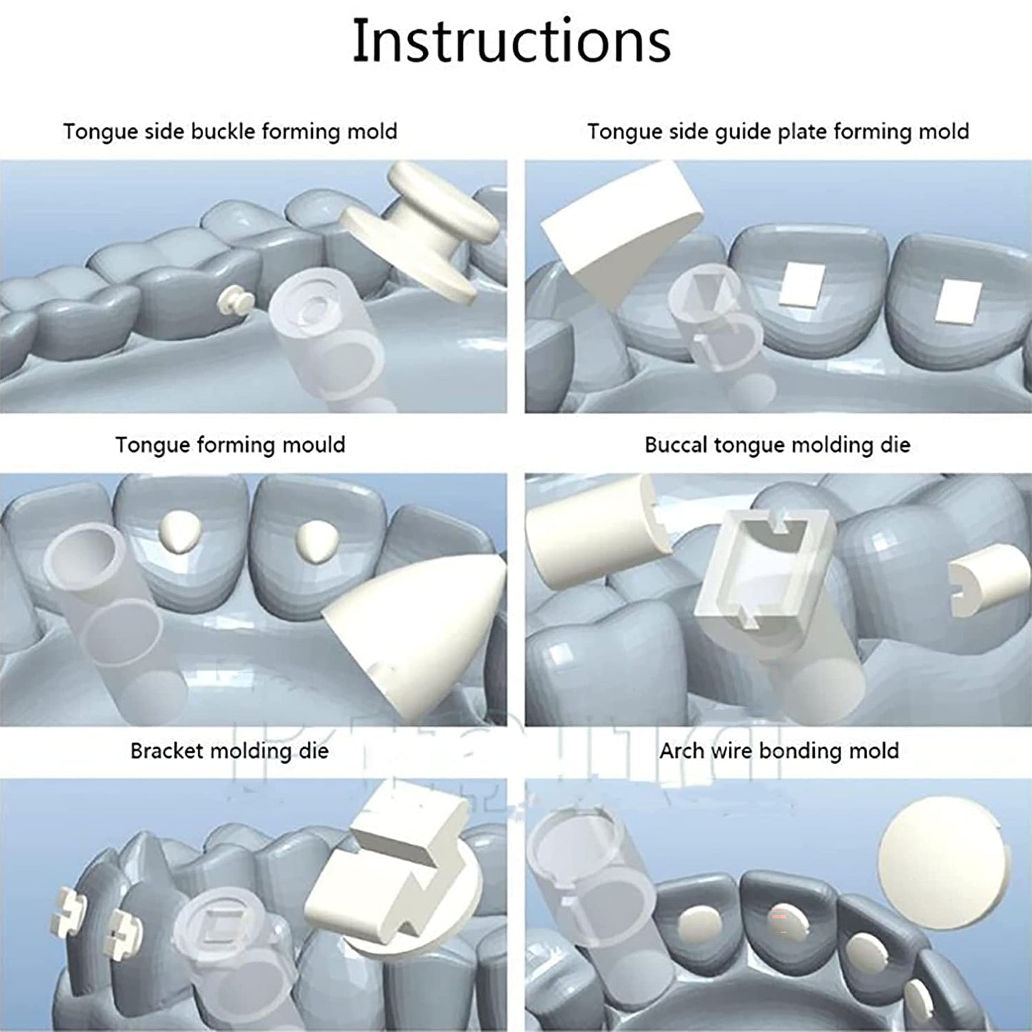 MO-6 Orthodontic Mould Mold Mini Orthodontic Accessories Injection Mould Starter Kit Tubes Lingual Retainer Button Set