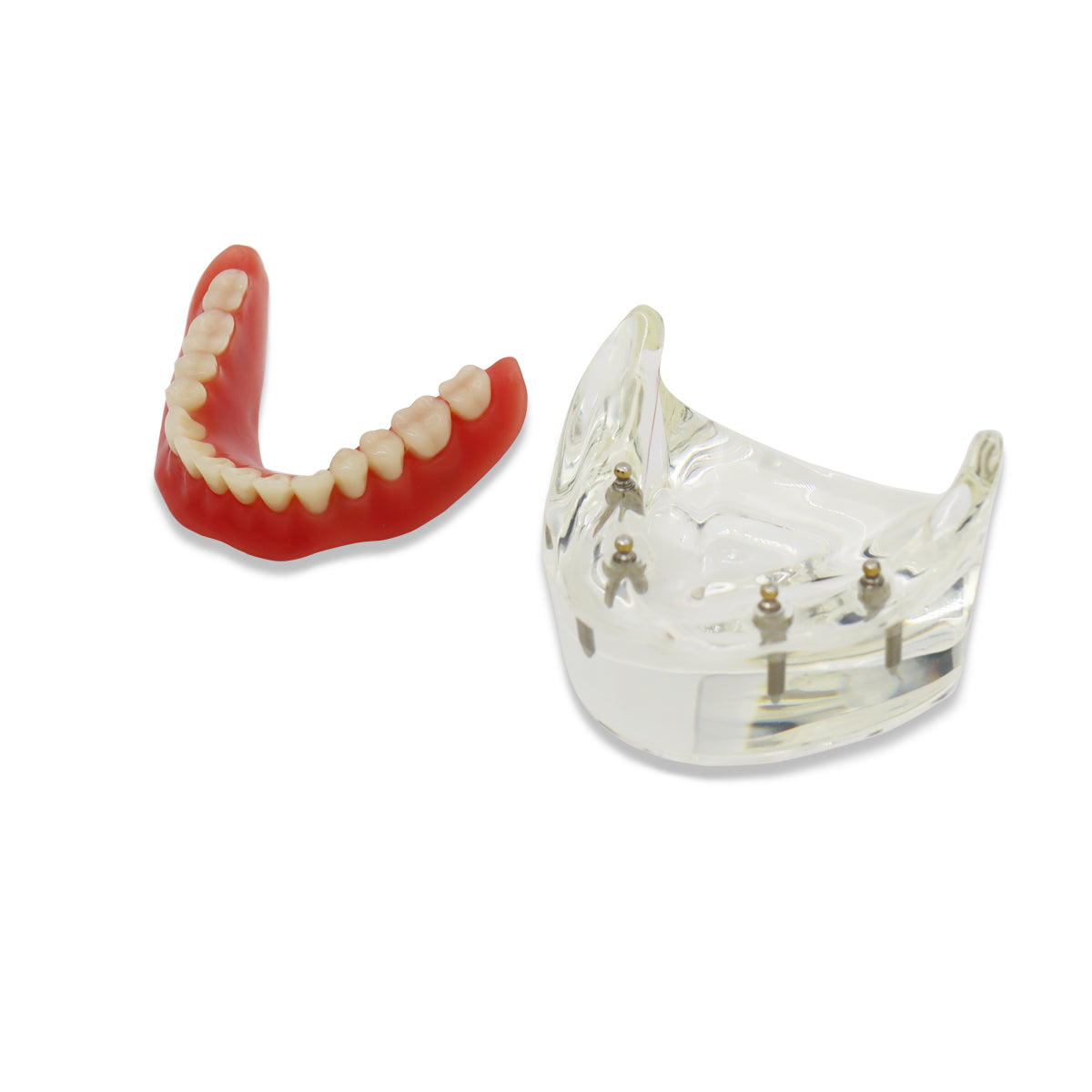 D-DT(Mandibular)Dental Teeth Model,Transparent Dental Implant Teeth Model Dentist Standard Disease Removable Tooth Pathological Teaching Model