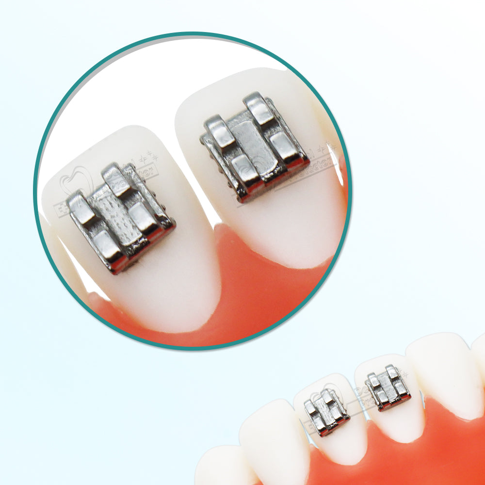10 Sets/Pack 200 pcs of Brackets 022 inch Slot 3-4-5 Hooks Edgewise Metal Brackets Braces,Silver,3mm