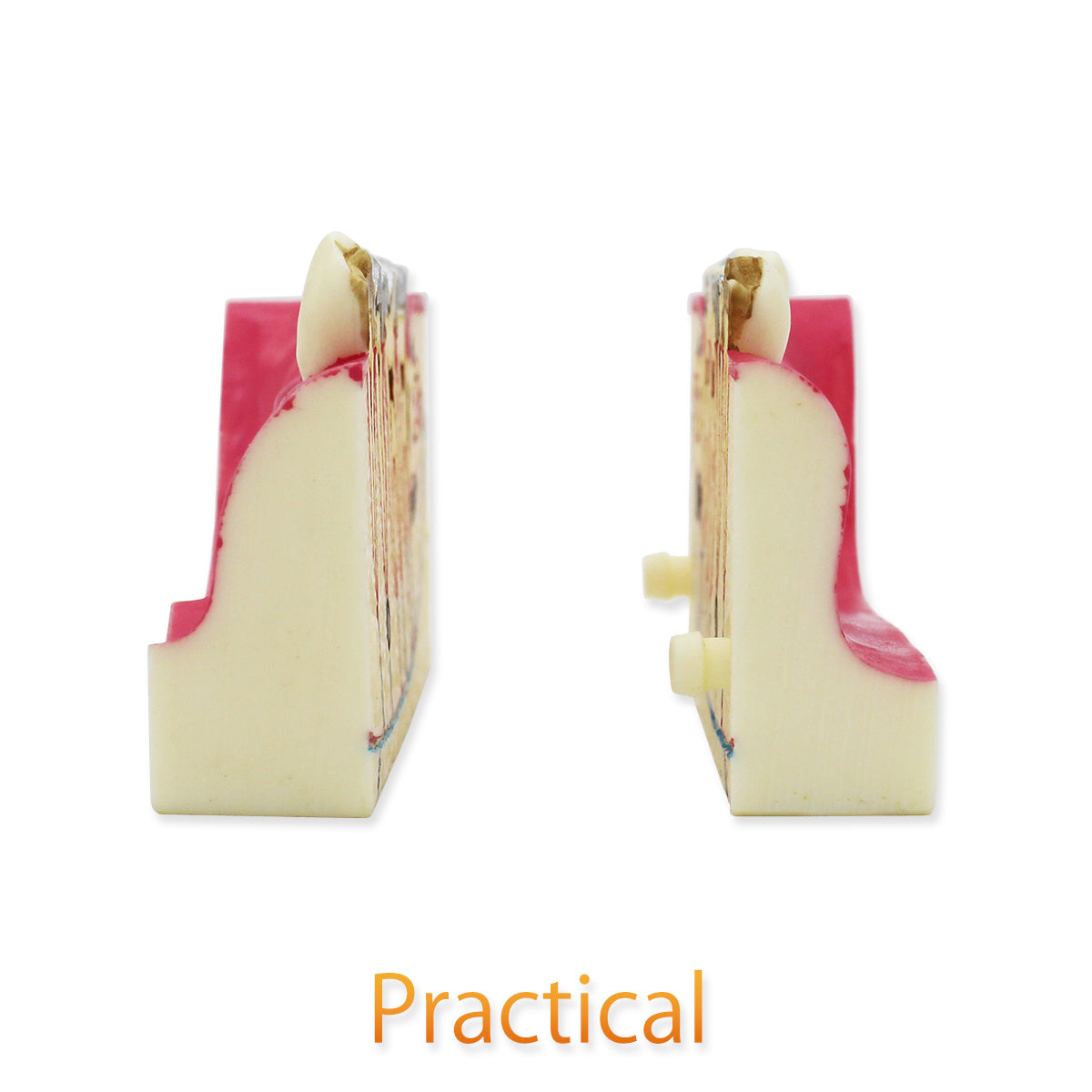 Dental Teeth Model,Transparent Dental Implant Teeth Model Dentist Standard Disease Removable Tooth Pathological Teaching Model(D-WD)