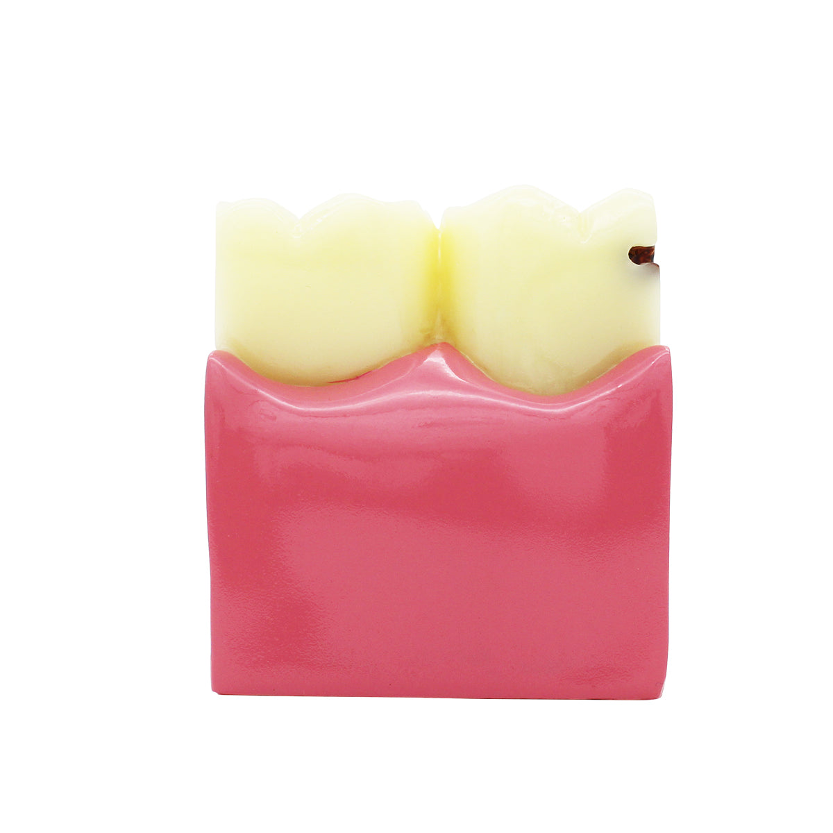 Dental Teeth Model,Transparent Dental Implant Teeth Model Dentist Standard Disease Removable Tooth Pathological Teaching Model(D-CA)