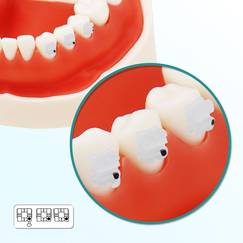 GOB-R0223 10 Packs Dental Orthodontic Brackets Ceramic Braces Bracket Braces Dental Roth Bracket 022"/018" Slot 3 with Hook