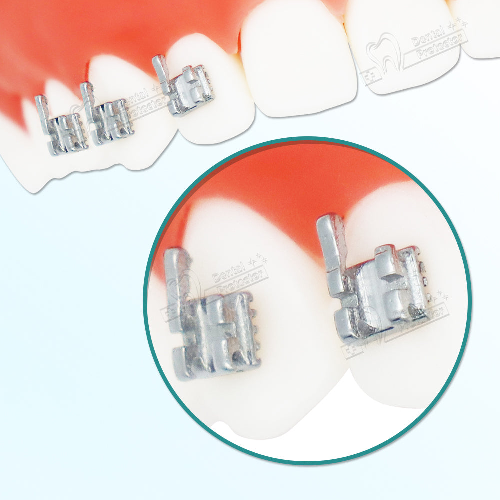 10 Sets/Pack 200 pcs of Brackets 022 inch Slot 3-4-5 Hooks Edgewise Metal Brackets Braces,Silver,3mm
