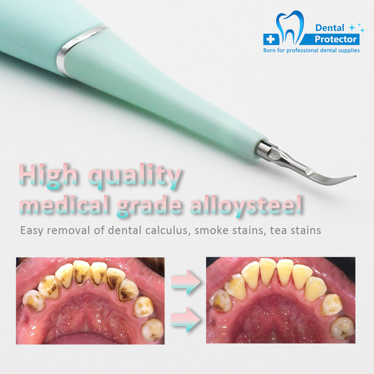 PROTECTOR Portable Electric Sonic Dental Scaler ToothC Tooth Stains Tartar Tool Dentist Whiten Teeth Health Hygiene white