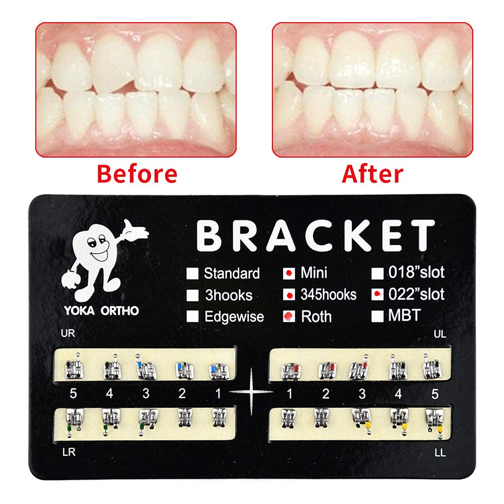 B10 200pcs/Pack Teeth Model Mini Roth Brackets Roth 022 Slot Bondable with Hook on 345