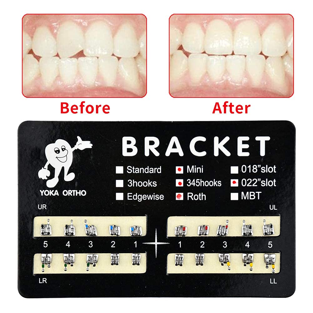 SJ Teeth Model Mini Roth Brackets Roth Different Slot Bondable Teeth Braces  Set with Hook - China roth brackets, teeth brackets