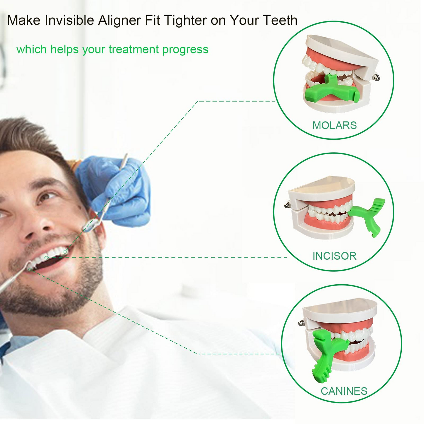 OC-6 Orthodontic Chewies,Chewies for Invisalign Aligners, Aligner Chewies for Aligner Trays Seater,Invisalign Munchies Orthodontic Dental Chewies Y-Shaped 2Pcs