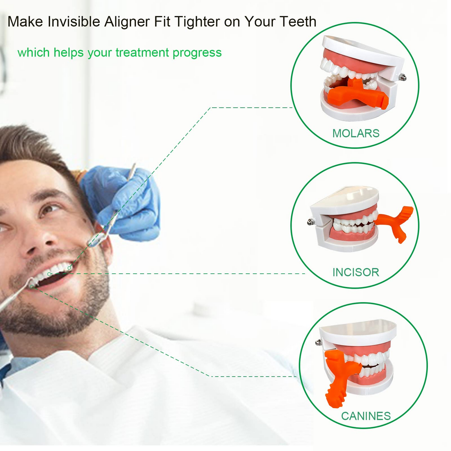 OC-6 Orthodontic Chewies,Chewies for Invisalign Aligners, Aligner Chewies for Aligner Trays Seater,Invisalign Munchies Orthodontic Dental Chewies Y-Shaped 2Pcs