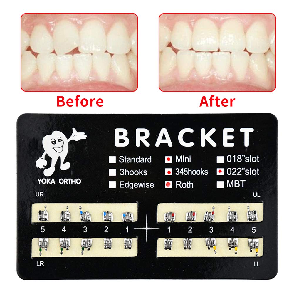 10 Sets/Pack 200 pcs of Brackets MIM Roth Mini 0.022 With Hook 3
