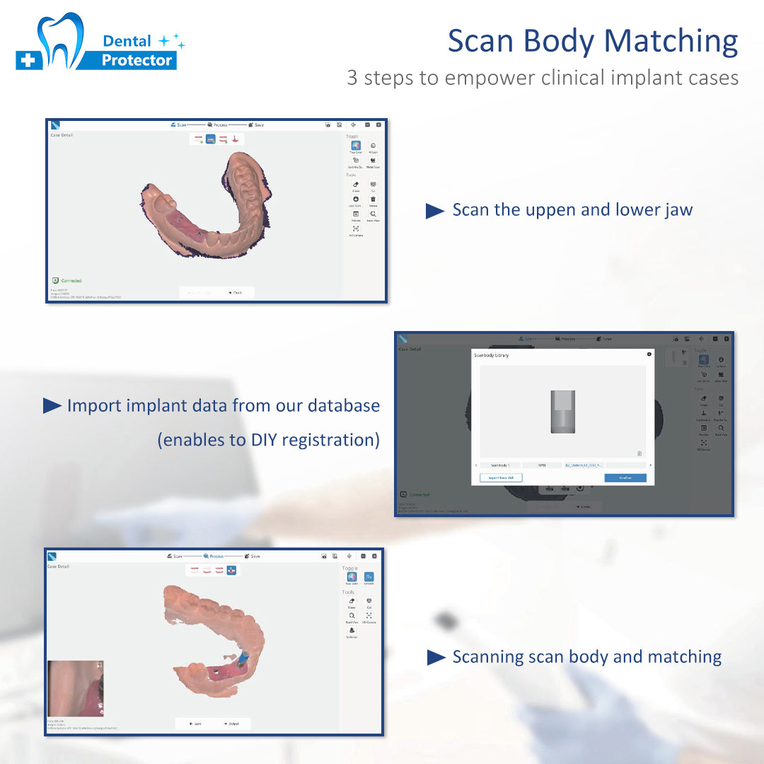 Professional Dental Intra Oral 3D Scanner Handpiece, Autoclavable Standard & Mini Scan Tips, Multi-Language Intraoral Scanner Complete Accessory Kit for Dental Lab Clinic