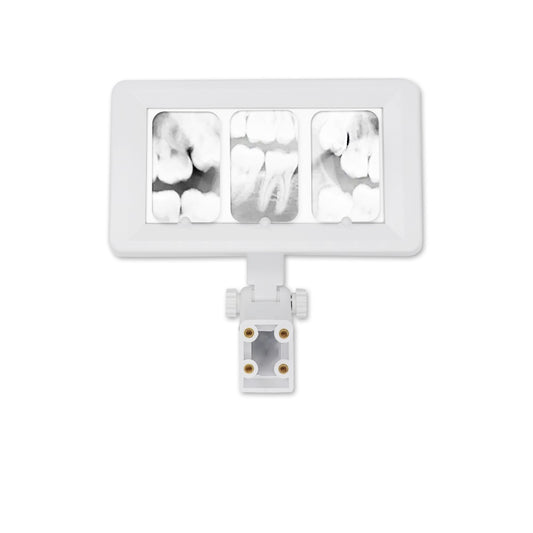 Dental Equipment X-Ray Film Illuminator Light Box X-ray Viewer Light Panel Screen Dentist Oral hygiene panorama AC24V