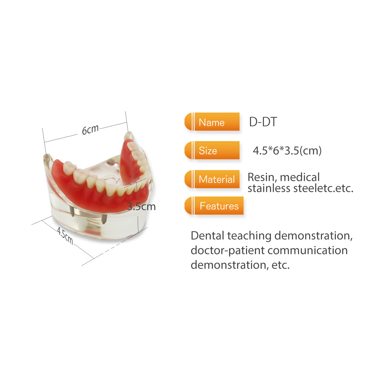 D-DT(Mandibular)Dental Teeth Model,Transparent Dental Implant Teeth Model Dentist Standard Disease Removable Tooth Pathological Teaching Model