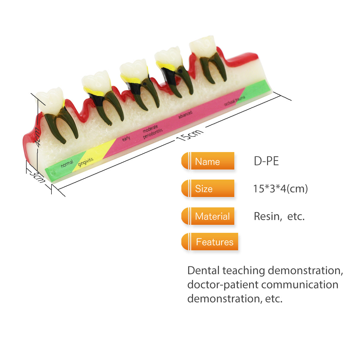 Dental Teeth Model,Transparent Dental Implant Teeth Model Dentist Standard Disease Removable Tooth Pathological Teaching Model(D-PE)