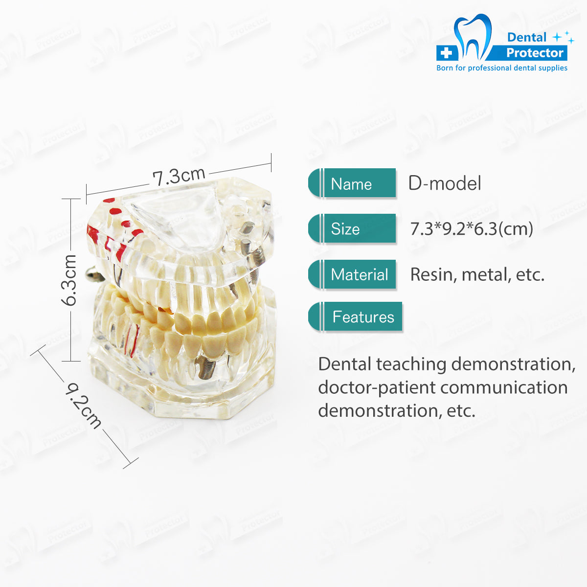 Transparent Disease Teeth Model, YOUYA DENTAL Transparent Dental Implant Teeth Model Dentist Standard Disease Removable Tooth Pathological Teaching Model
