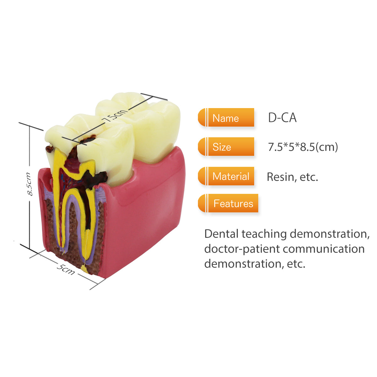 Dental Teeth Model,Transparent Dental Implant Teeth Model Dentist Standard Disease Removable Tooth Pathological Teaching Model（D-CA）