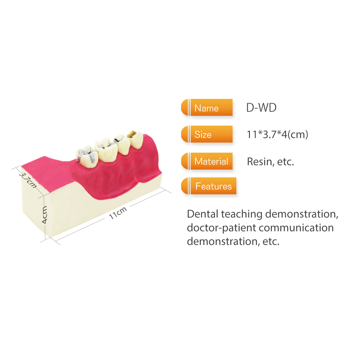 Dental Teeth Model,Transparent Dental Implant Teeth Model Dentist Standard Disease Removable Tooth Pathological Teaching Model(D-WD)