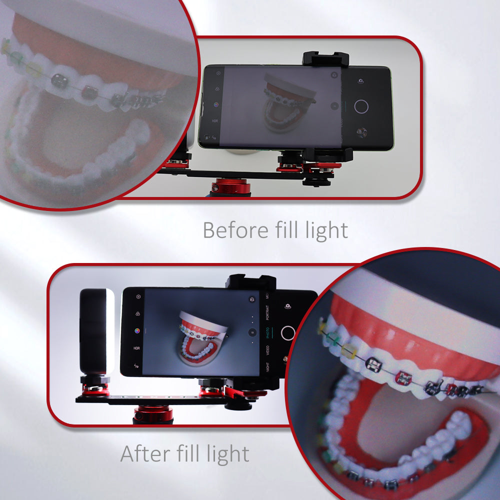 Bluetooth Dental Flash Light Photography Equipment Dentistry LED Oral Filling Light for Dentist Lighting Dental Photo Flash light