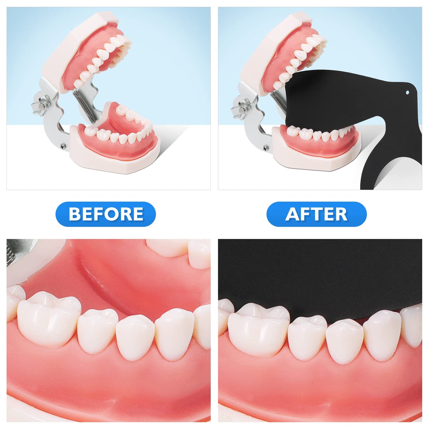 6 Pcs Dental Contraster Intraoral Photographic Dental Black Background Board Dental Photo Contrast Kit