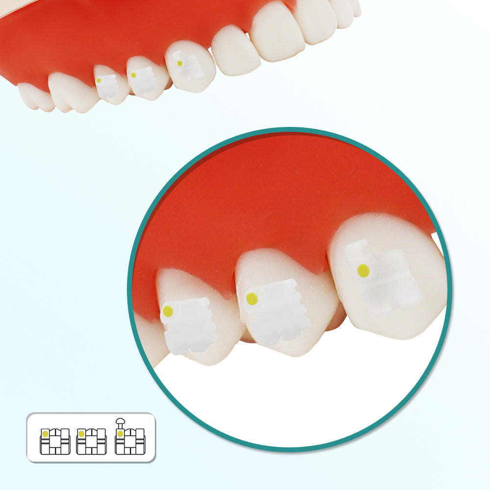 GOB-R0223 10 Packs Dental Orthodontic Brackets Ceramic Braces Bracket Braces Dental Roth Bracket 022"/018" Slot 3 with Hook