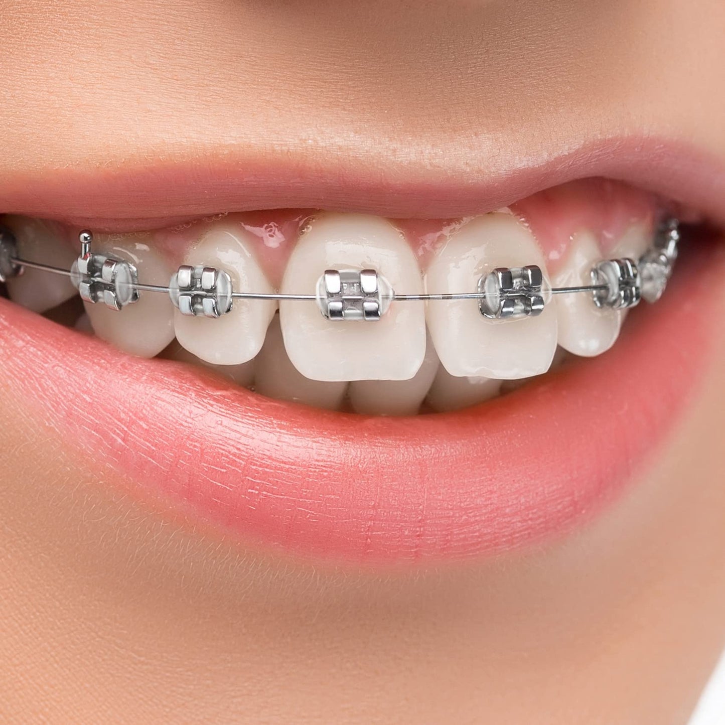 Dental Orthodontic Ligature Ties Braces 1040 Pcs, Ortho Braces Color Bands Ligature Ties Elastomeric O-Rings for Braces